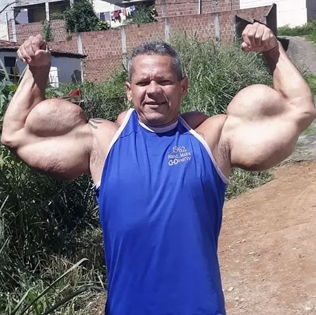 โWith Heavy Hearts: A Global Sensationโs Extreme Obsession Ends in Tragedy at 55 🕊️โ